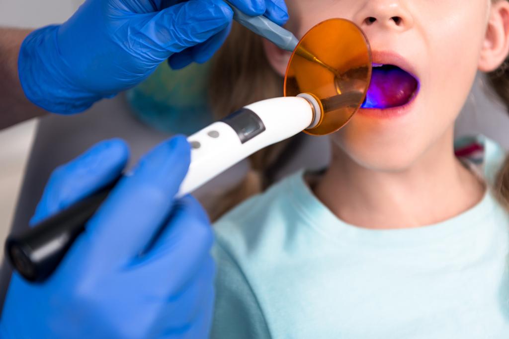 小さな子供の歯科硬化手順の歯科医のショットをトリミング - 写真・画像