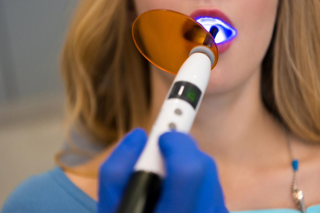 rajattu kuva hammaslääkärin kanssa hampaiden kovettumisen valo työskentelee naispuolinen asiakas
 - Valokuva, kuva