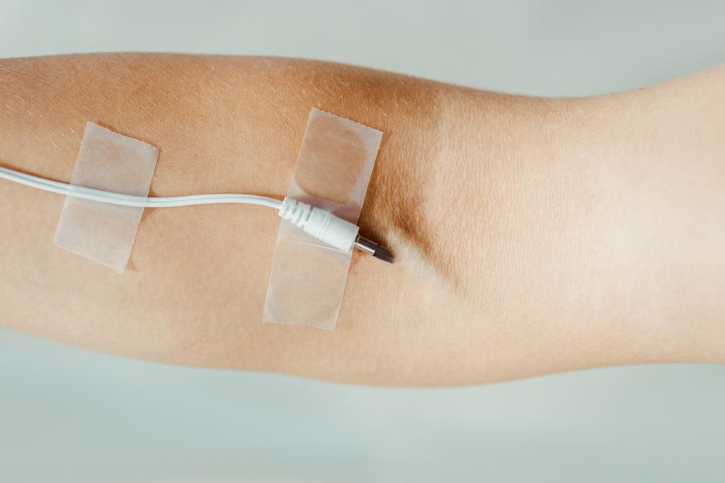 close up da mão feminina com cabo branco anexado como infusão IV médica isolada em cinza, conceito de música
  - Foto, Imagem