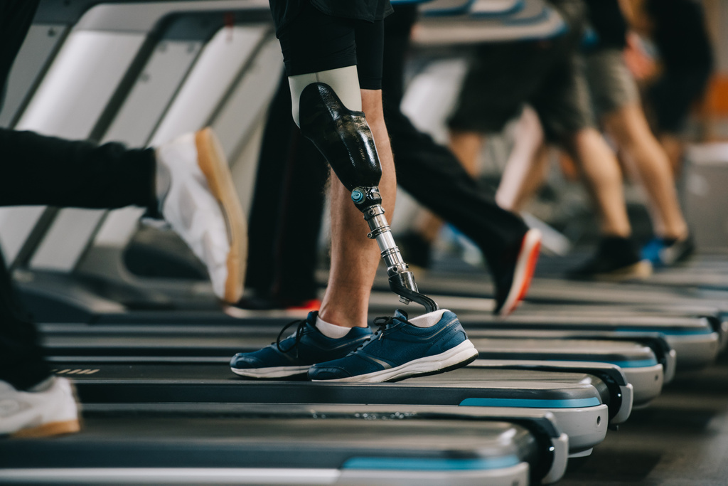 colpo ritagliato di sportivo con gamba artificiale che corre sul tapis roulant in palestra con altre persone
 - Foto, immagini