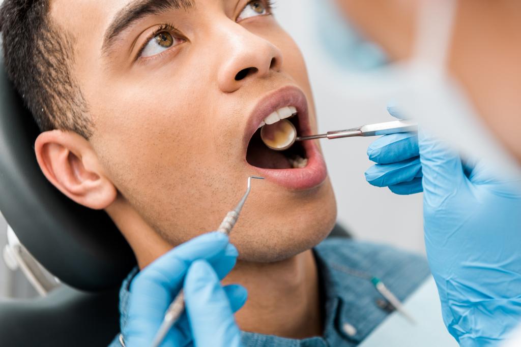 primo piano di uomo afro-americano a bocca aperta durante l'esame in clinica dentale
  - Foto, immagini