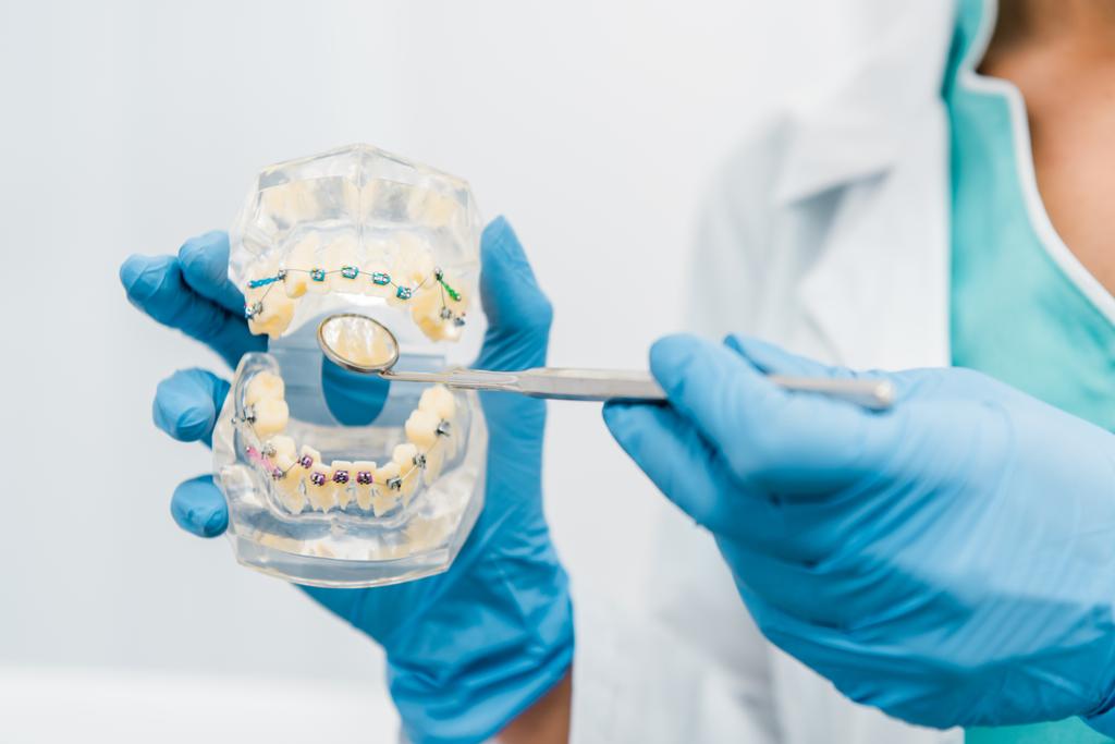 oříznutý pohled modelu zubní čelisti v rukou stomatologa v latexové rukavice  - Fotografie, Obrázek