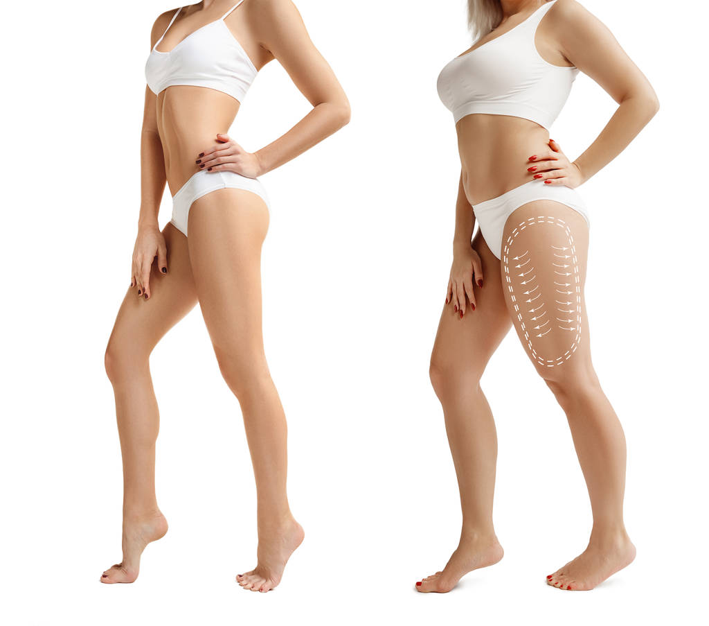 Dos mujeres jóvenes gruesas y delgadas tienen diferentes figuras
 - Foto, Imagen