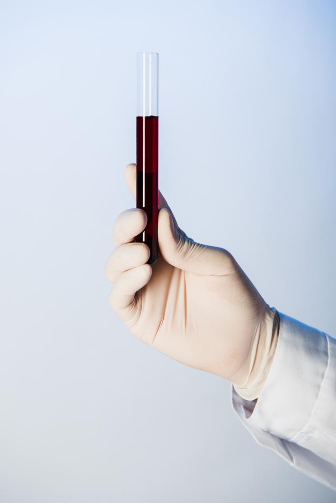 Частковий вигляд лікаря, який тримає пробірку з кров'ю
  - Фото, зображення