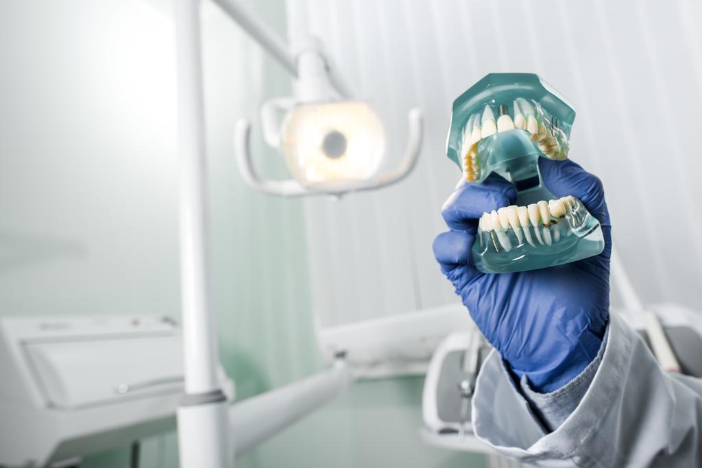 latex kesztyű, a kezében tartja a fogak modell nézet fogorvos övben - Fotó, kép