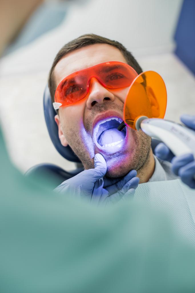 selectieve aandacht voor een patiënt met geopende mond tijdens de procedure in de buurt van tandarts bleken - Foto, afbeelding