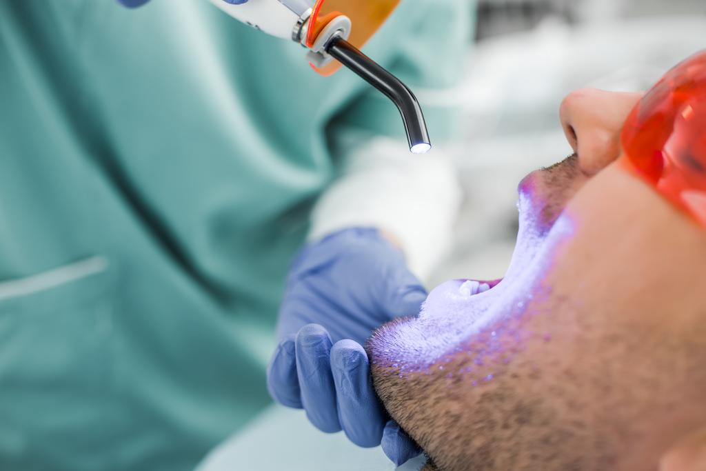 primo piano del dentista rendendo procedura di sbiancamento al paziente
  - Foto, immagini
