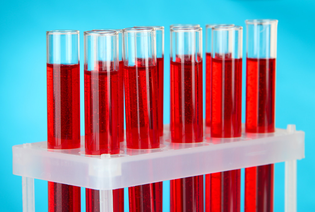 Test tubes with blood in laboratory - Photo, Image