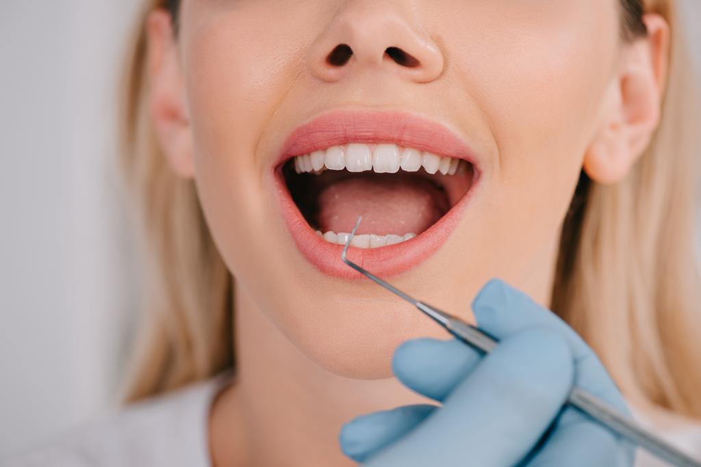 weergave van tandarts behandeling van tanden van jonge vrouw met tandheelkundige sonde bijgesneden - Foto, afbeelding