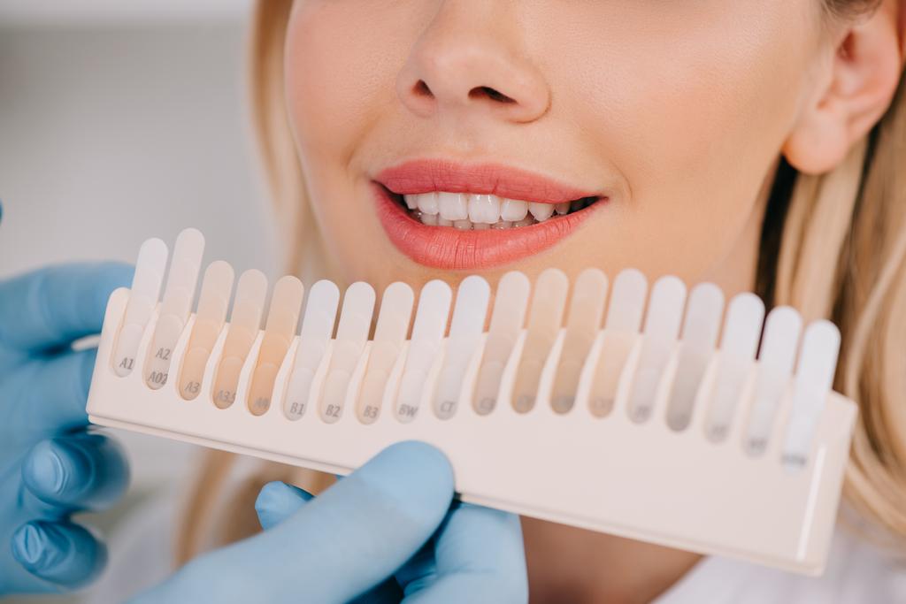 обрезанный вид мужского стоматолога, совпадающий цвет зубов женщины с палитрой в клинике, концепция отбеливания зубов
 - Фото, изображение