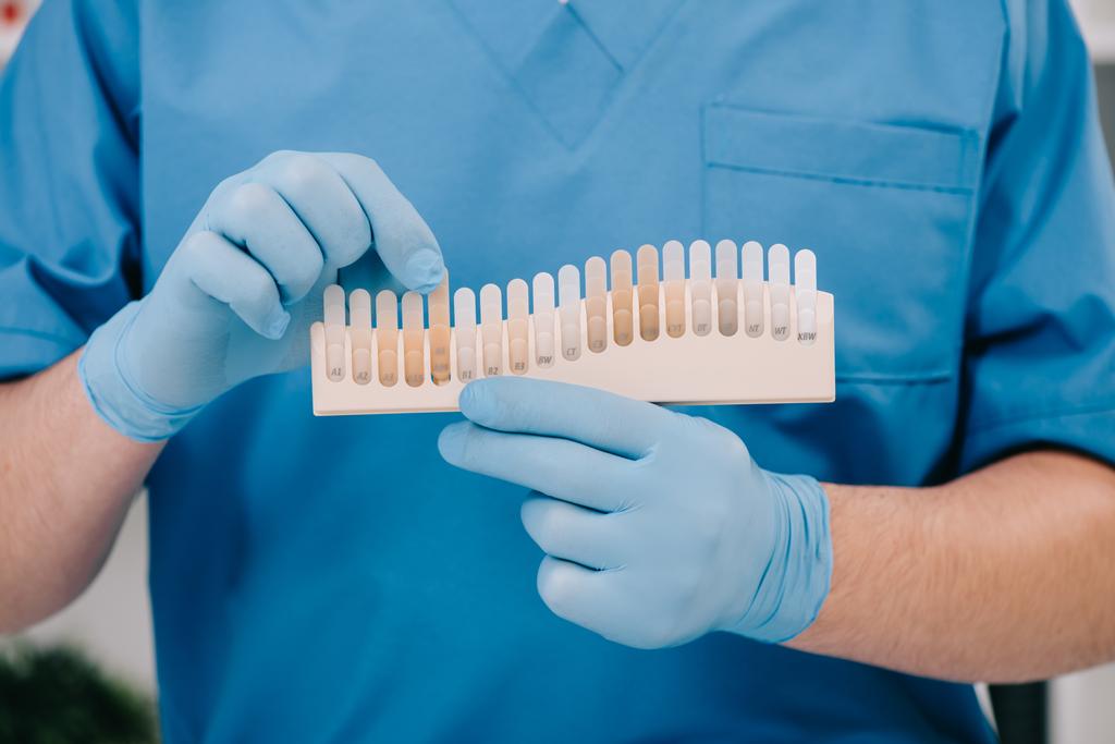 обрезанный вид стоматолога с цветовой палитрой зубов в клинике, концепция отбеливания зубов
 - Фото, изображение