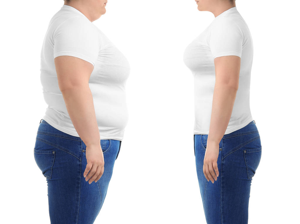 Übergewichtige Frau vor und nach der Gewichtsabnahme auf weißem Hintergrund, Nahaufnahme - Foto, Bild