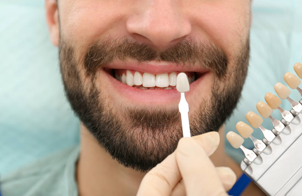 Fogorvos illő fiatalember fogak színes paletta, Vértes - Fotó, kép