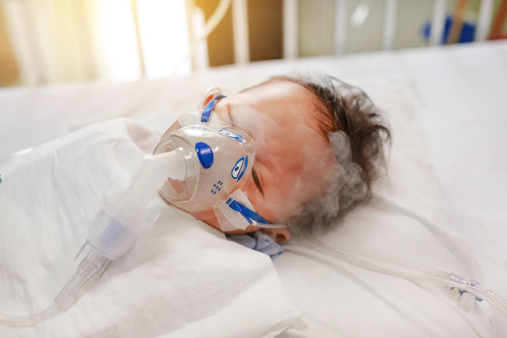 Inhalación bebé niño edad alrededor de 1 año de edad en la cama del paciente. Virus respiratorio sincitial (VRS). Cuidados intensivos en cama en el hospital
. - Foto, Imagen