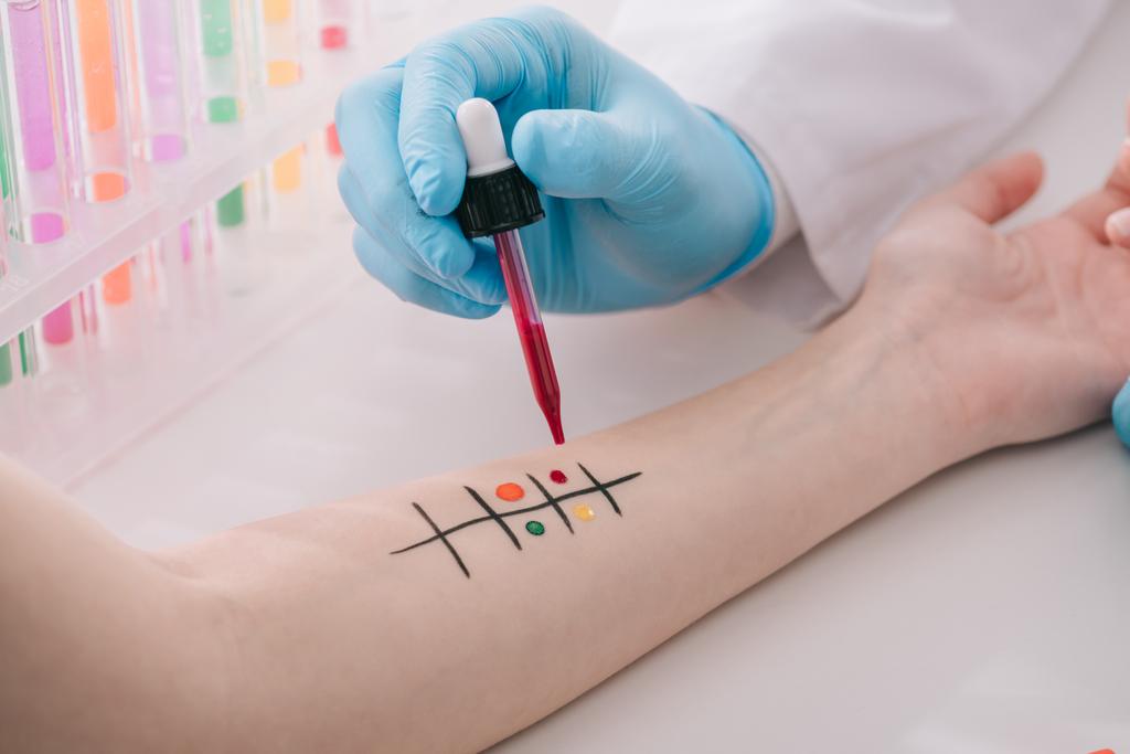 Ausgeschnittene Ansicht des Arztes in Latex-Handschuh, der Pipette mit Flüssigkeit hält, während er Allergietests macht  - Foto, Bild