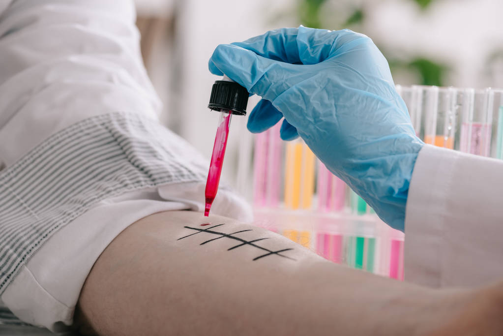 Ausgeschnittene Ansicht des Arztes im Latexhandschuh, der Pipette mit roter Flüssigkeit in der Nähe der markierten männlichen Hand im Labor hält  - Foto, Bild