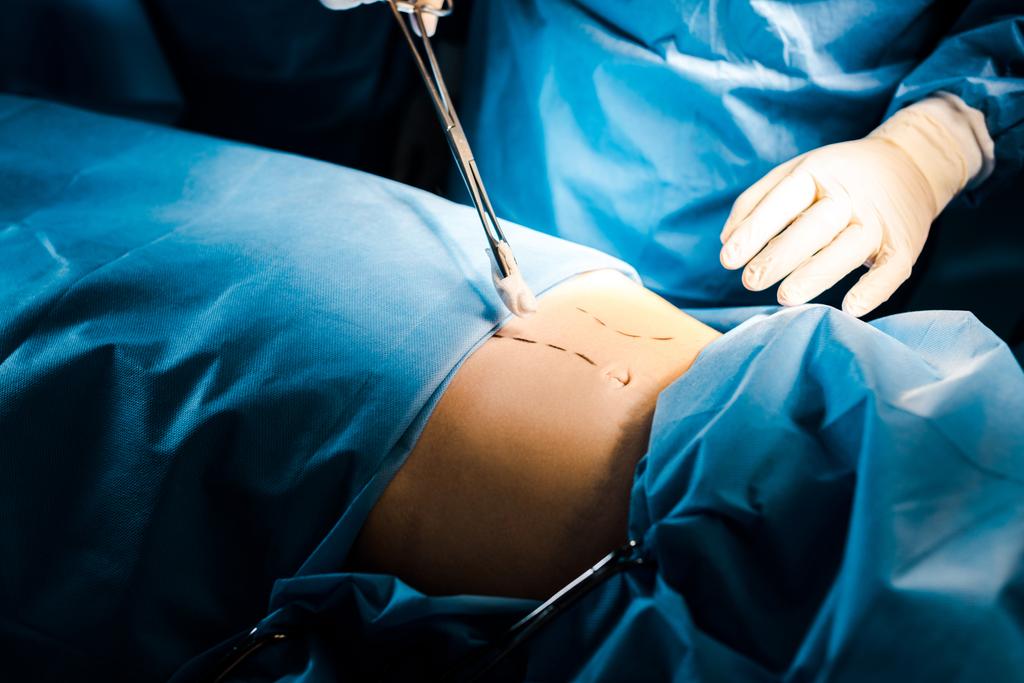περικομμένη άποψη του χειρουργού που κάνει λειτουργία με ιατρικό εξοπλισμό  - Φωτογραφία, εικόνα