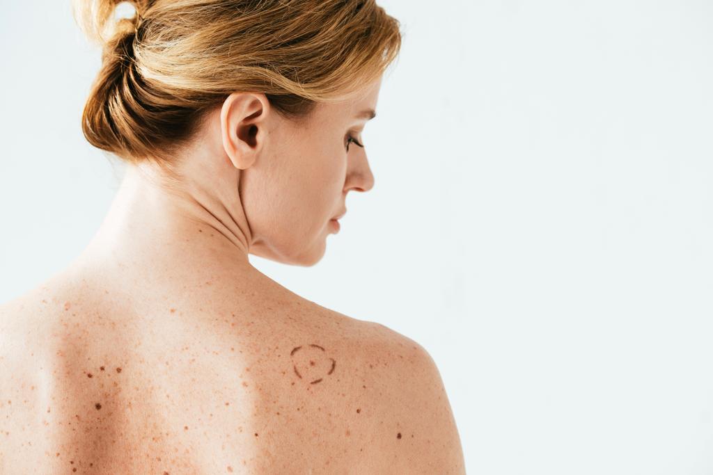 atractiva mujer con marcas en la espalda aislada en blanco
   - Foto, imagen