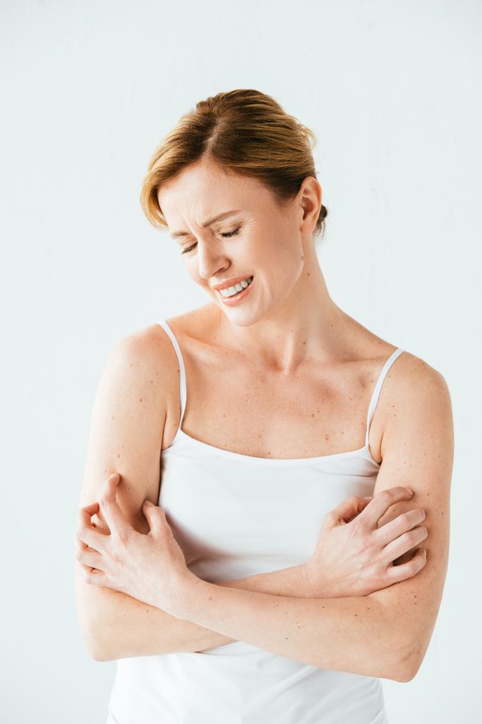 mujer atractiva con enfermedad de la piel rascarse la piel aislada en blanco
  - Foto, imagen