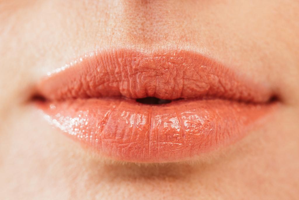 close up of herpes on lips of sick woman  - Photo, Image