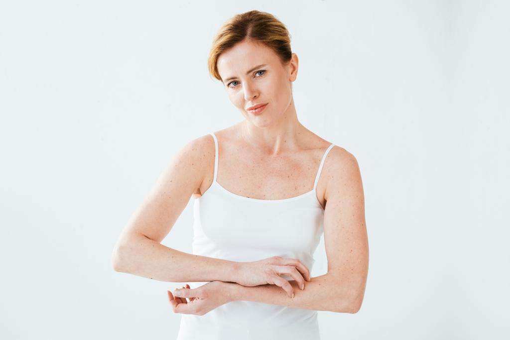 atrakcyjny alergiczny kobieta drapanie skóry na białym  - Zdjęcie, obraz