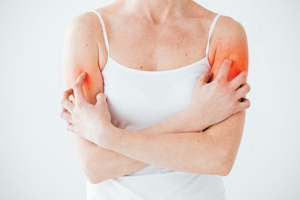 nyírt kilátás a nő allergia karcolás vörös bőr fehér  - Fotó, kép