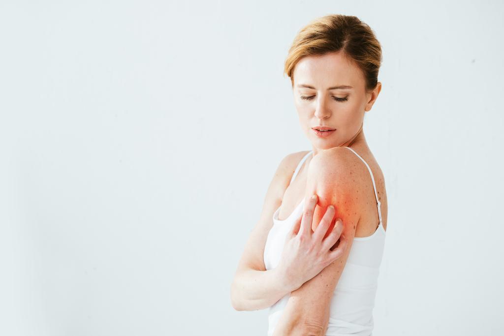 αρκετά άρρωστη γυναίκα με αλλεργία να ξύνει κόκκινο δέρμα στο λευκό  - Φωτογραφία, εικόνα