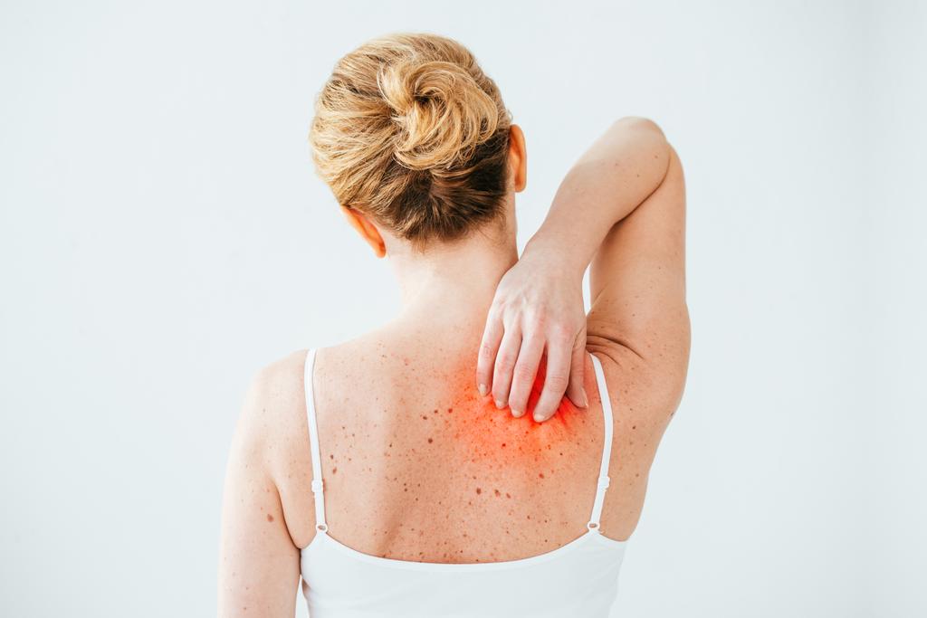 περικομμένη όψη της άρρωστης γυναίκας με αλλεργία στο κόκκινο δέρμα που απομονώνεται σε λευκό  - Φωτογραφία, εικόνα