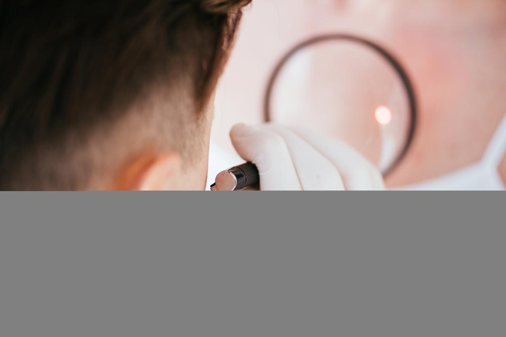 黒色腫の女性の近くに虫眼鏡を保持している皮膚科医のトリミングビュー  - 写真・画像