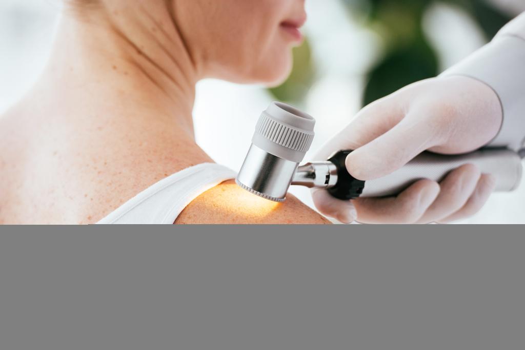 обрезанный взгляд дерматолога, держащего дерматоскоп во время обследования пациента
   - Фото, изображение