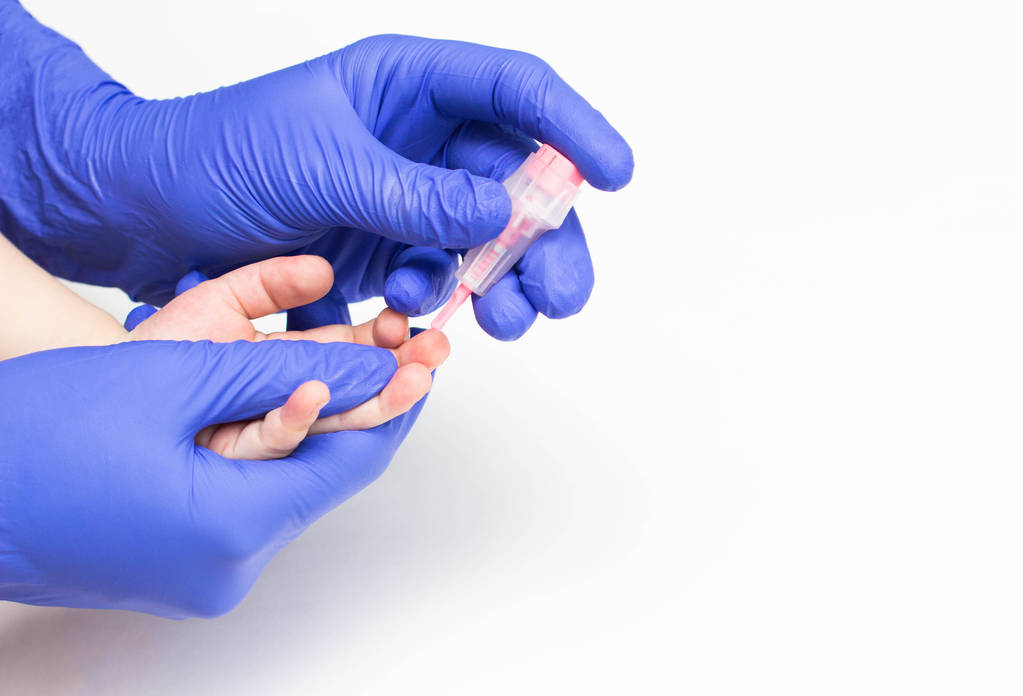 Il dottore prende il sangue da un dito. Un esame del sangue comune con uno scarificatore in un bambino per i valori di eritrociti e soia, primo piano, spazio di copia, infiammazione
 - Foto, immagini