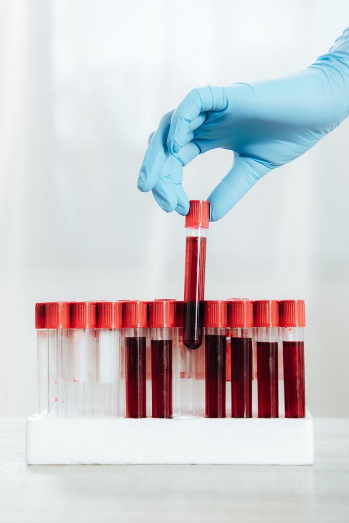 περικομμένη όψη του γιατρού σε γάντι λατέξ κρατώντας δοκιμαστικό σωλήνα με αίμα - Φωτογραφία, εικόνα