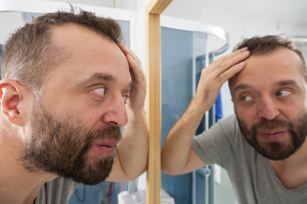 Aggódó ember nézi a csökkenő hajszálvonal - Fotó, kép