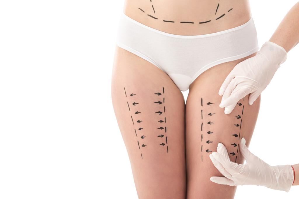 částečný pohled na plastického chirurga v latexových rukavicích a pacientovi v kalhotkách s označením na těle izolovaně na bílém - Fotografie, Obrázek