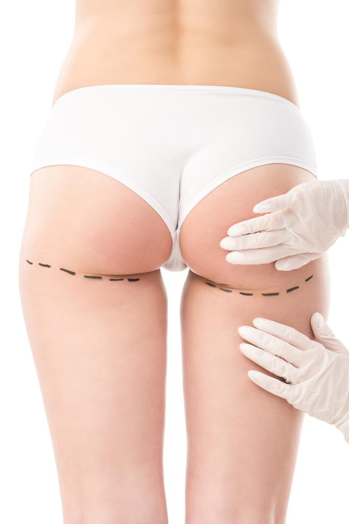 cropped view of plastic surgeon in latex gloves and patient in panties with marks on body isolated on white - Photo, Image