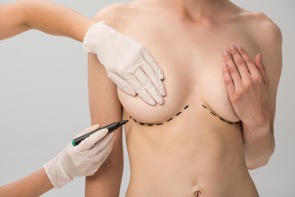 обрізаний вид пластичного хірурга в латексних рукавичках робить сліди на грудях ізольовані на сірому
 - Фото, зображення