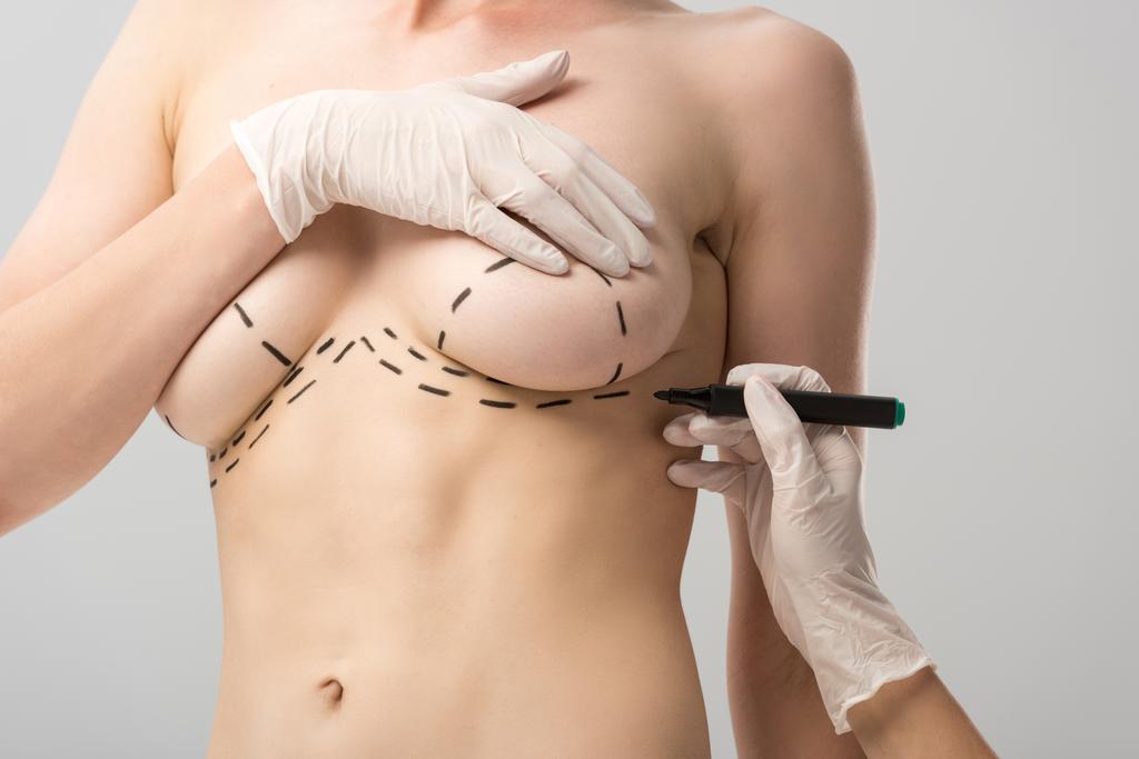 vue recadrée du chirurgien plasticien dans des gants en latex faisant des marques sur le sein isolé sur gris
 - Photo, image