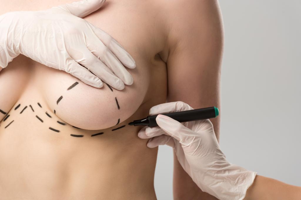 обрезанный вид пластического хирурга в латексных перчатках, оставляющих отметины на груди, выделенные на серой
 - Фото, изображение