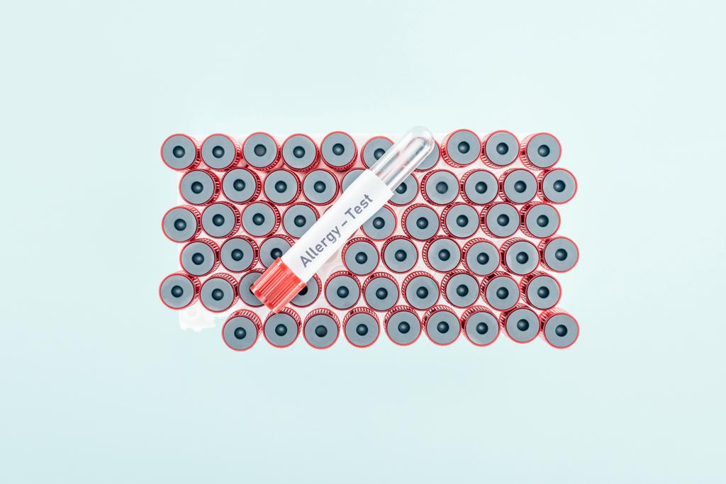 top view of empty test tube with allergy test lettering isolated on blue - Photo, Image