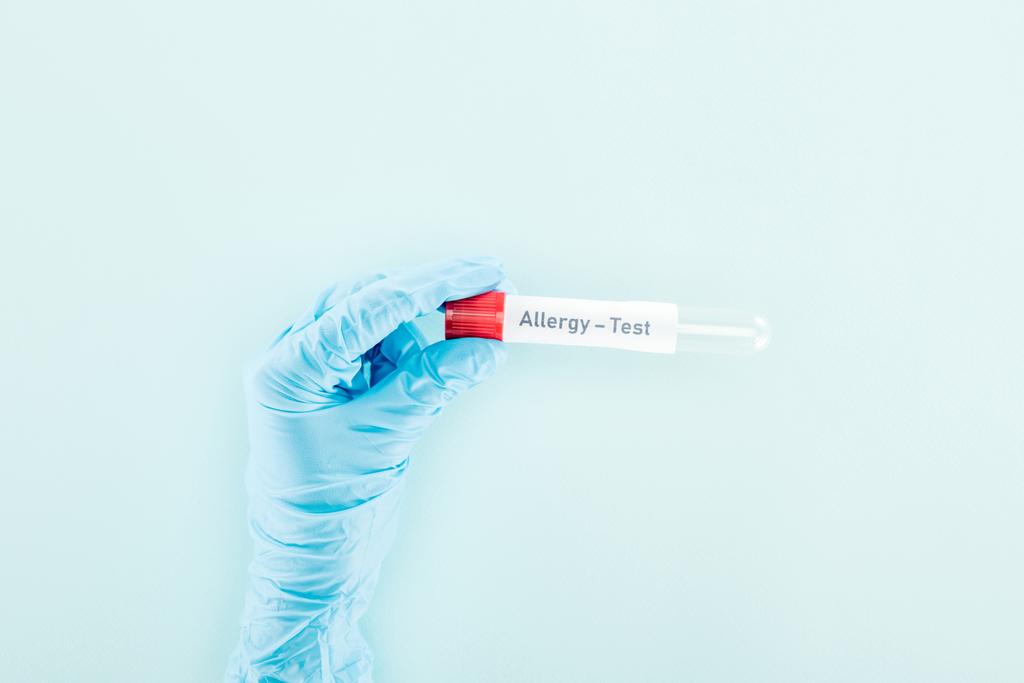 oříznutý pohled na lékaře v latexové rukavici držící prázdnou zkumavku s alergií test na modrém - Fotografie, Obrázek
