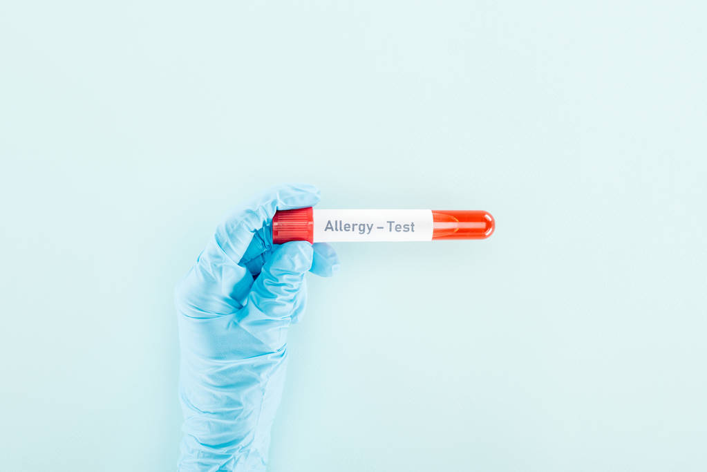 περικομμένη θέα του γιατρού στο γάντι λατέξ κρατώντας δείγμα με αλλεργία δοκιμή γράμματα απομονωμένη σε μπλε  - Φωτογραφία, εικόνα