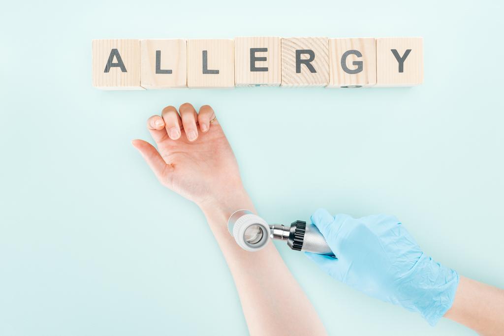 przycięte widzenia lekarza badanie ręki kobiety z Dermatoskopu w pobliżu bloków drewnianych z alergią słowo izolowane na niebiesko - Zdjęcie, obraz