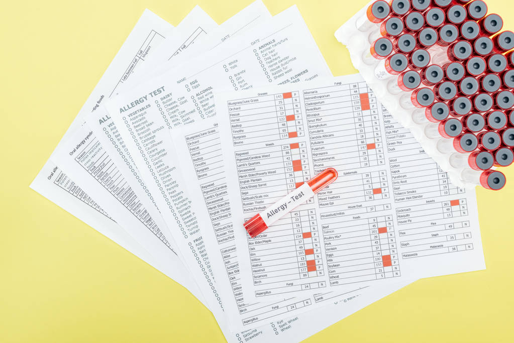 黄色で分離されたアレルギーテストレタリングを持つ試験管の近くのアレルギー試験結果のトップビュー - 写真・画像