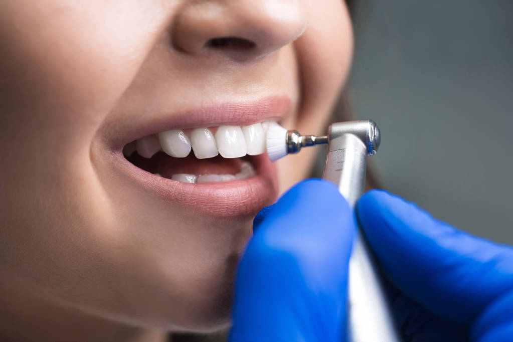 процесс использования стоматологической щетки в качестве этапа профессиональной процедуры стоматологической очистки в клинике крупным планом
 - Фото, изображение