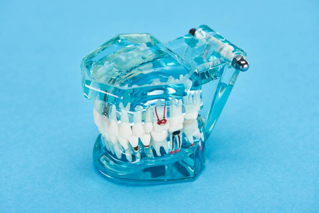 μοντέλο δοντιών με κόκκινες οδοντικές ρίζες σε λευκά δόντια στο μπλε  - Φωτογραφία, εικόνα