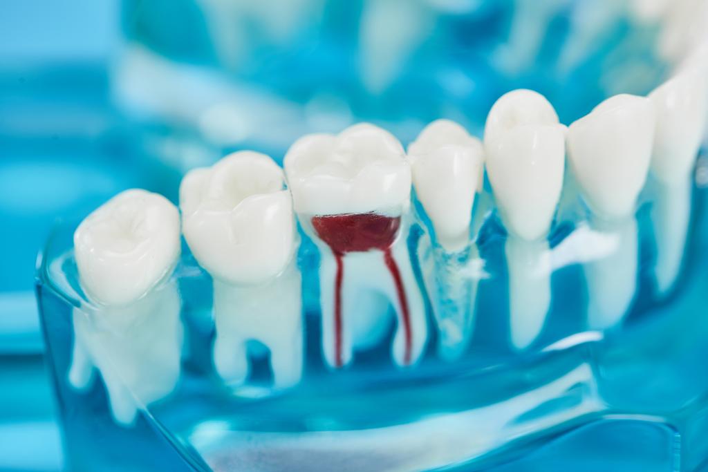 beyaz dişler ve kırmızı diş kökü ile diş modeli seçici odak  - Fotoğraf, Görsel