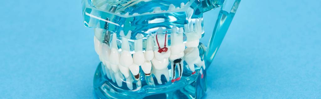 panoraama laukaus hampaiden malli punainen hampaiden juuri valkoiset hampaat sininen
  - Valokuva, kuva