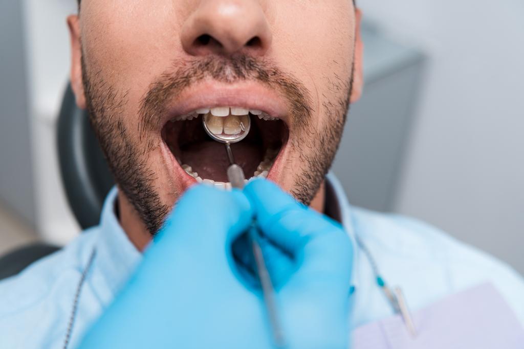 Ausgeschnittene Ansicht des Zahnarztes, der dem Patienten den Zahnspiegel im Mund hält  - Foto, Bild
