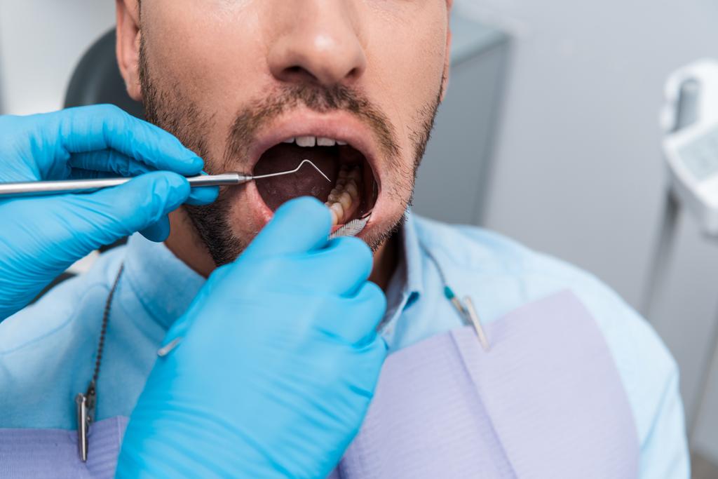 περικομμένη όψη του οδοντιάτρου που κατέχει οδοντιατρικά όργανα στο στόμα του με γένια ασθενή στην κλινική  - Φωτογραφία, εικόνα
