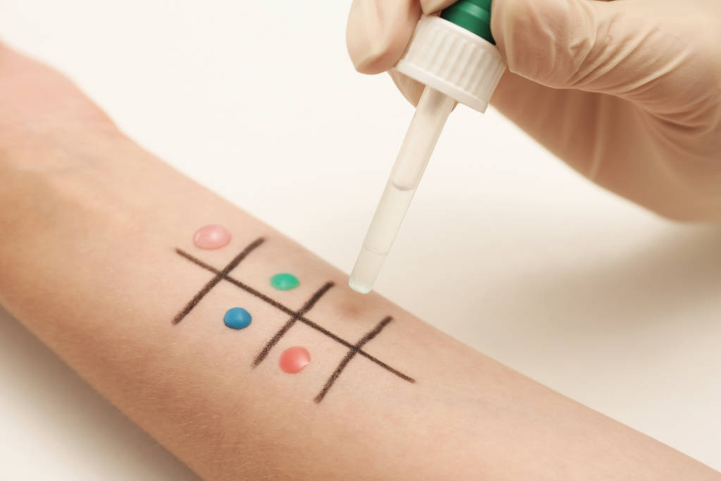 Пацієнт проходить тест на алергію на шкіру за легким столом, крупним планом
 - Фото, зображення